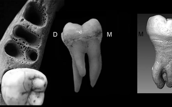 Зубы с тремя корнями достались жителям Азии от денисовцев