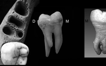 Зубы с тремя корнями достались жителям Азии от денисовцев