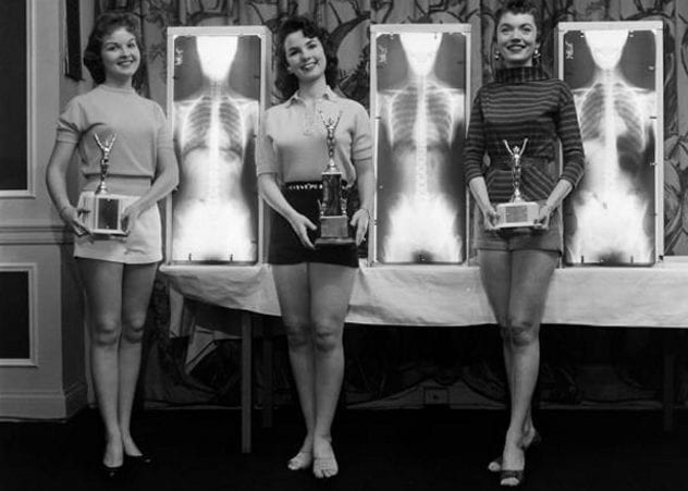 Мисс красивые лодыжки и Королева золотых рыбок: 15 самых странных конкурсов красоты в истории мира