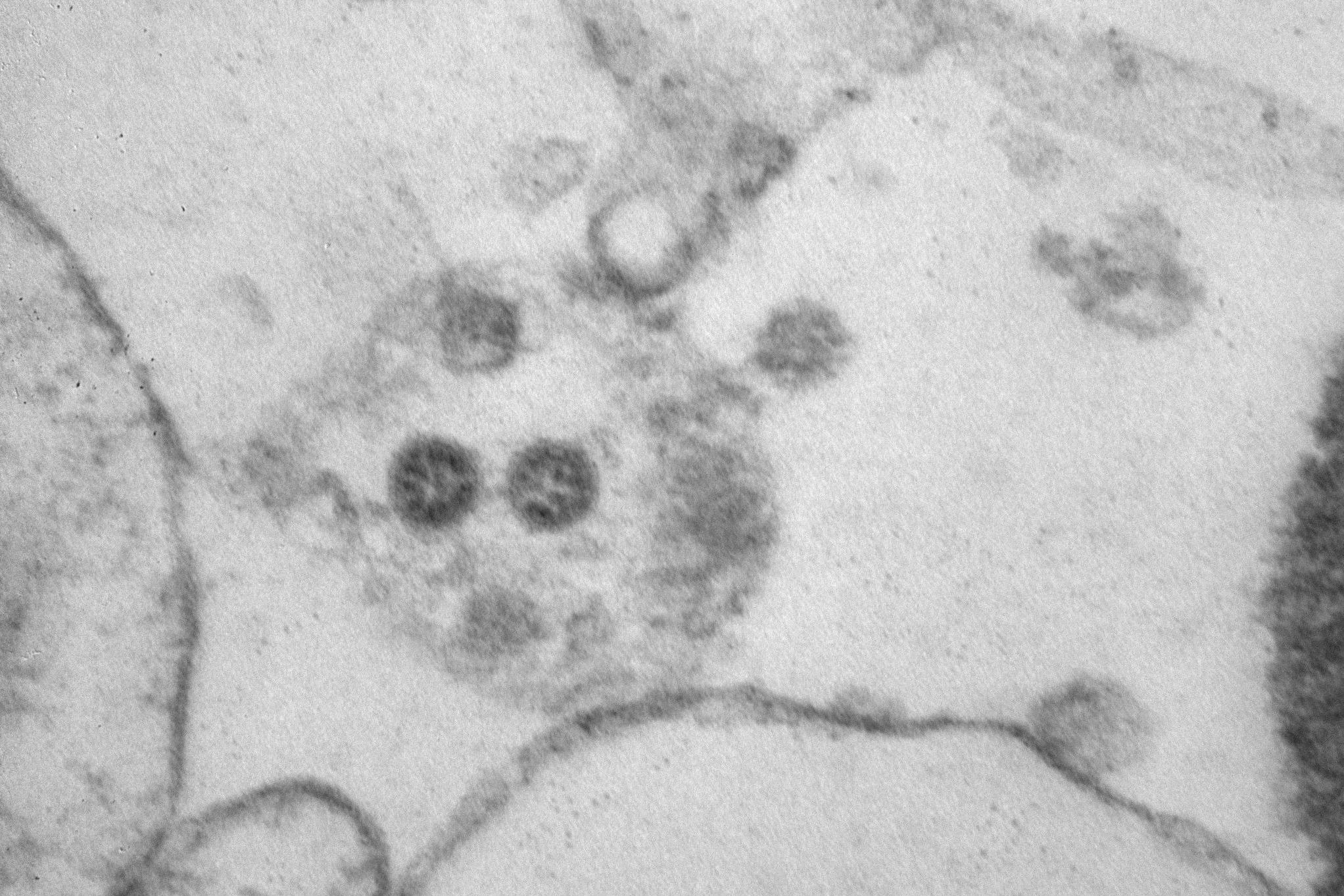 Штамм ковида 2024. Ковид коронавирус Омикрон. Штамм вируса Омикрон под микроскопом. Вирус ковид Омикрон под микроскопом. Дельта штамм коронавируса под микроскопом.