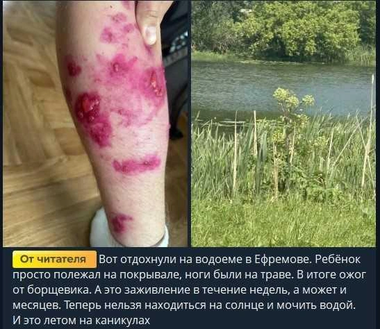 Пост от родителя пострадавшего ребенка | Источник: Телеграм-канал «Тула Жесть»
