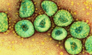 Роспотребнадзор рекомендовал проверять на коронавирус всех пациентов с кашлем и температурой
