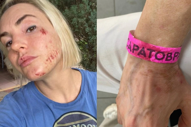 В доказательство своих слов Ольга приложила фото и видео | Источник: Ольга Бекетова / Телеграм-канал