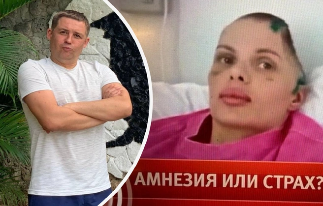 Рассказываем, что известно о возлюбленном лишившейся половины черепа модели Тартановой | Источник: личная страница Дмитрий Кузьмина; «Пусть говорят» / Первый канал