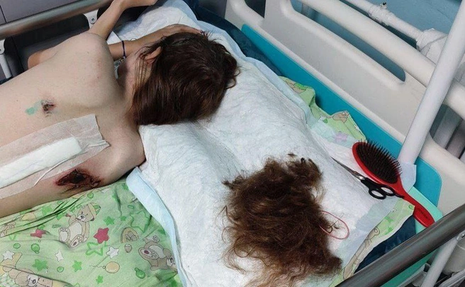 Виктория Кирдина перенесла несколько операций и долго была прикована к постели. Ей также пришлось остричь волосы | Источник: семья Кирдиных