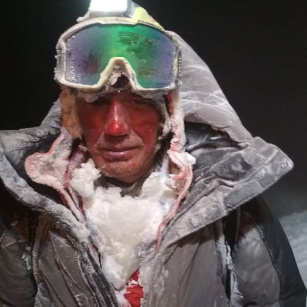 Жуткие фото альпинистов, выживших на Эльбрусе
