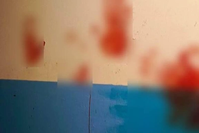 В Тюмени голый мужчина измазал стены кровью на Олимпийской