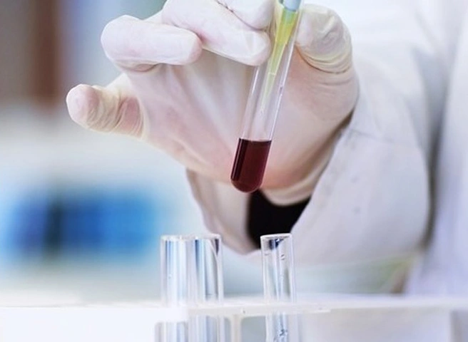 В Рязанской области выявлено еще два случая коронавируса | ya62.ru