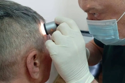 Забайкальцы могут проверить родинку у онколога через МАХ бесплатно