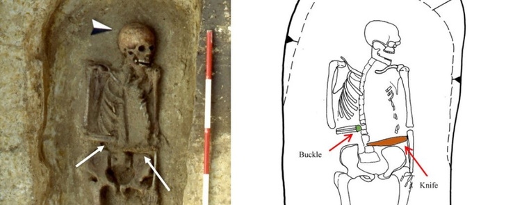 Обнаружен скелет средневекового «киборга»