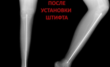 А так - с уже установленной конструкцией | Источник: Российская детская клиническая больница (РДКБ) / Vk.com 