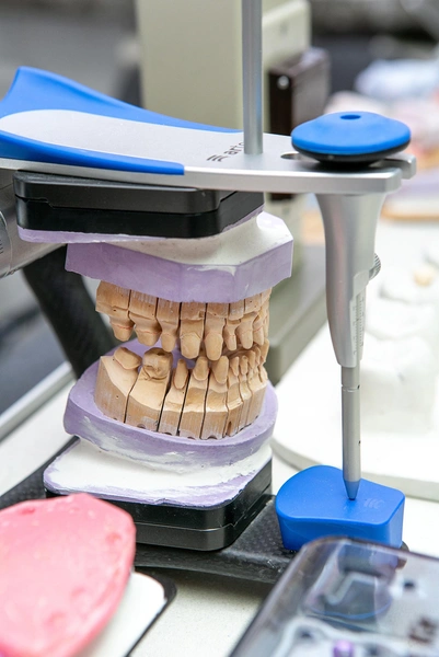 Источник: центр стоматологических решений «РЕСПЕКТ»