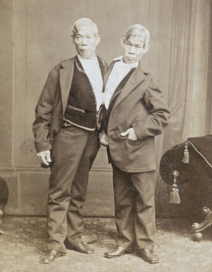 London Stereoscopic Company / Stringer / Getty ImagesСиамские близнецы Чанг и Энг Банкеры (1811 - 1874), фото около 1870 года
