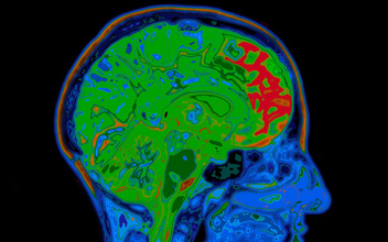 Телепатия по науке: нейробиологи научились читать мысли с помощью МРТ
