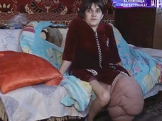 «Разрушены кости и суставы»: гигантская опухоль на ноге сломала жизнь 23-летней девушке