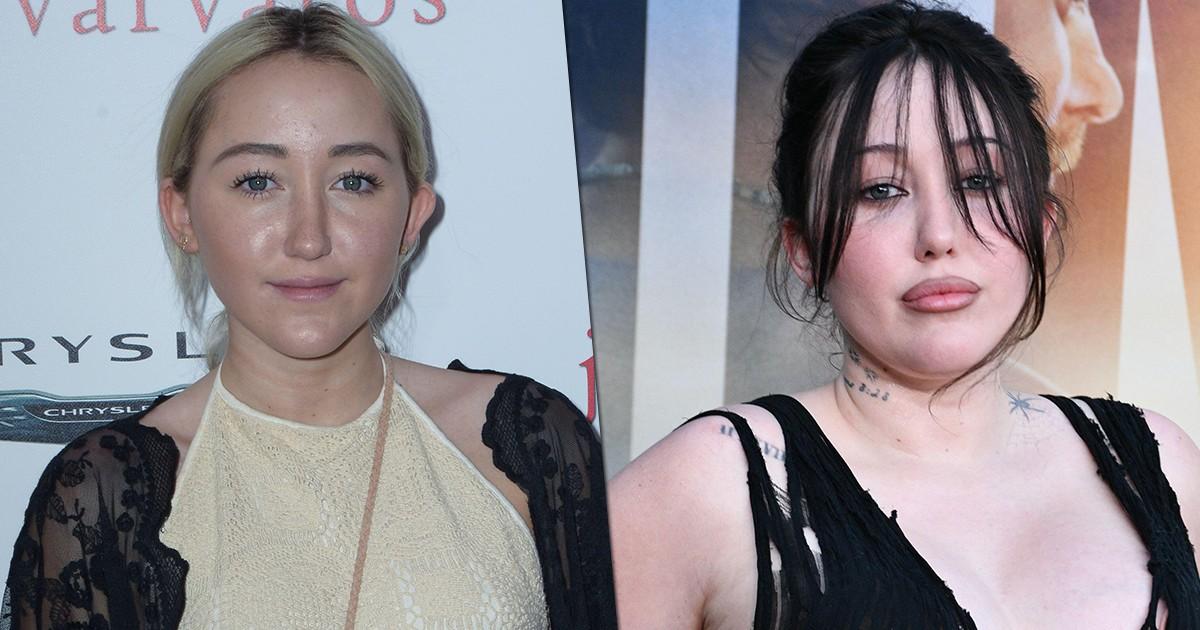 Все пластические операции сестры Майли Сайрус, которая так мечтала быть похожей на нее, что стала другим человеком