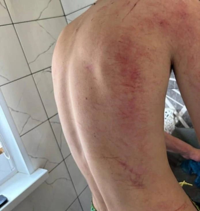 Травмы одного из пострадавших | Источник: читатель 74.RU
