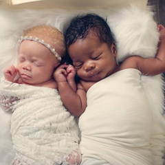 «Я думала, ребенка подменили»: мать родила двойняшек с разным цветом кожи