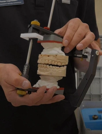 Проводить точную диагностику помогает кондилограф, фиксируя параметры движения челюсти в виде компьютерных графиков | Источник: «МЕГА-ДЕНТ»