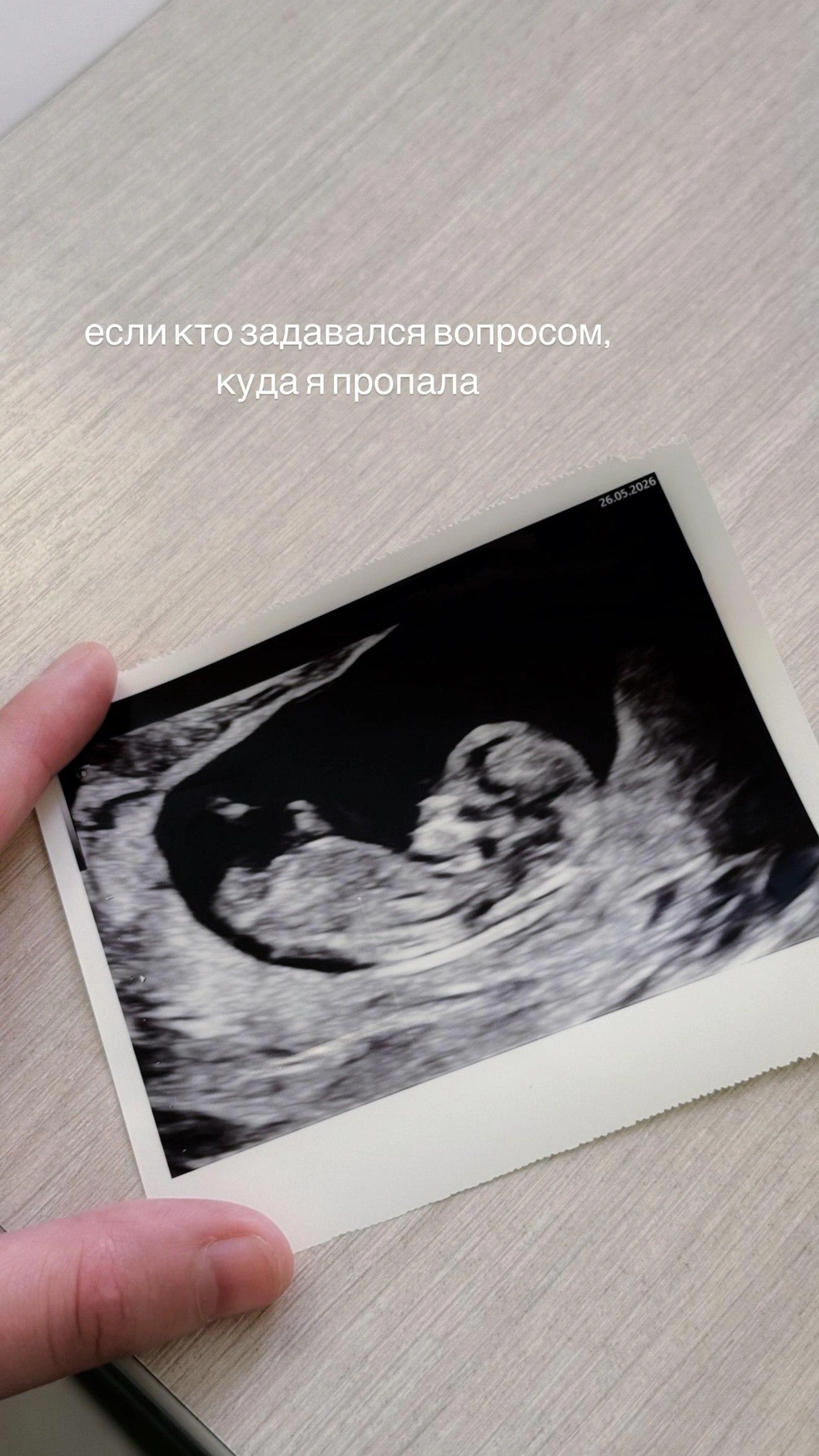 И Маша, и Юлик опубликовали в соцсетях снимок УЗИ | Источник: маша мармарис печатает.. / T.me