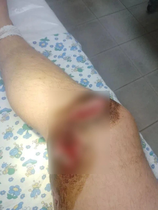 Мужчине буквально разорвали ноги | Источник: Дмитрий Асеев
