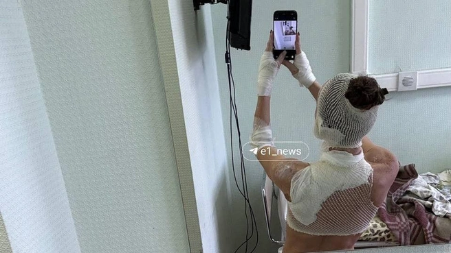 Сейчас пострадавшая в больнице | Источник: читательница E1.RU