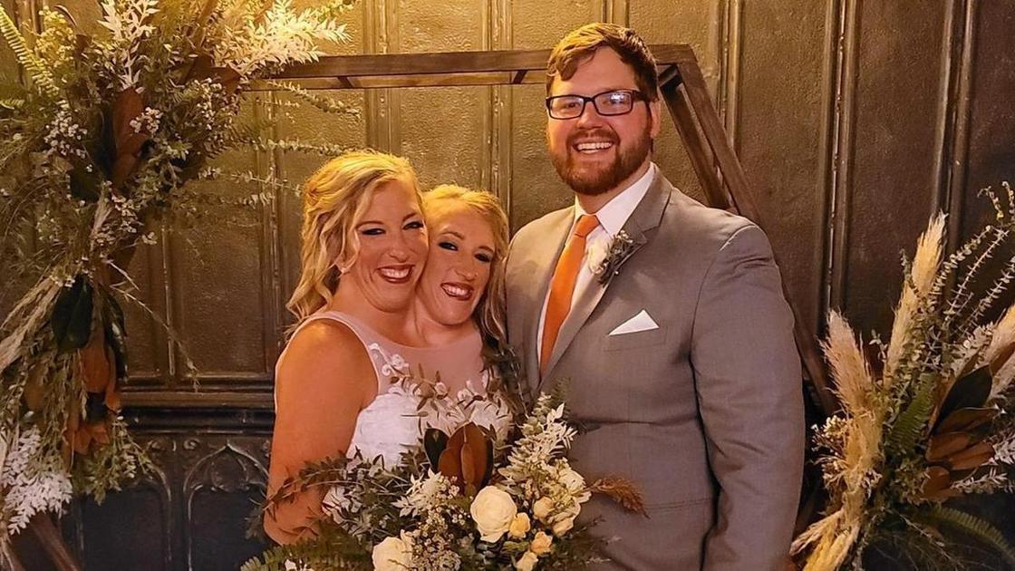 Как сегодня живут сиамские близнецы Хенсел, ставшие мамами