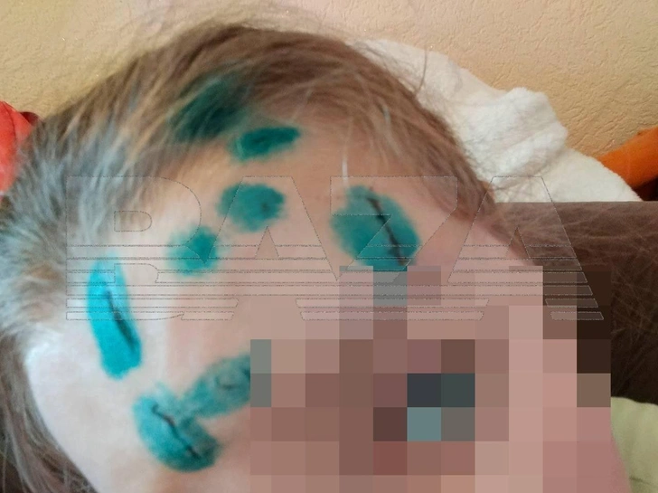 Местные говорят, что агрессивный бомбаж известен по кличке «Метела»