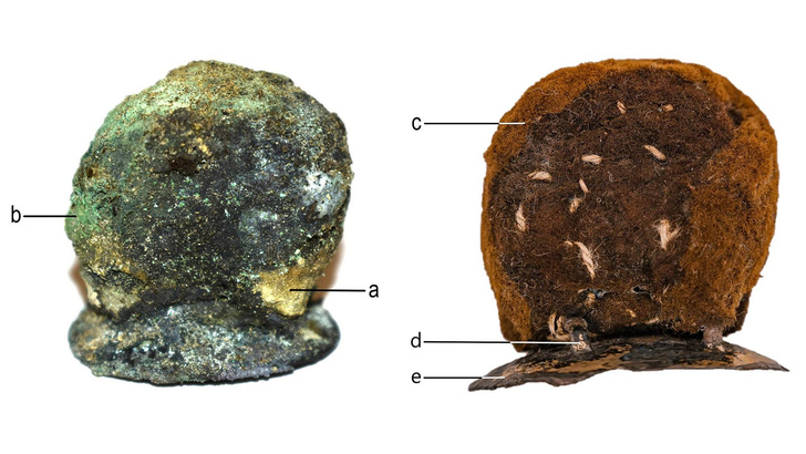 300-летний протез из шерсти и драгметаллов нашли археологи: кому это устройство облегчало жизнь?