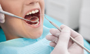 Петербургские стоматологи рассказали, почему и как надо лечить молочные зубы