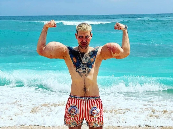 Блогер рассказал, как чуть не остался без руки | Источник: ruki_bazuki_official / Instagram.com (экстремистская организация, деятельность запрещена на территории РФ)