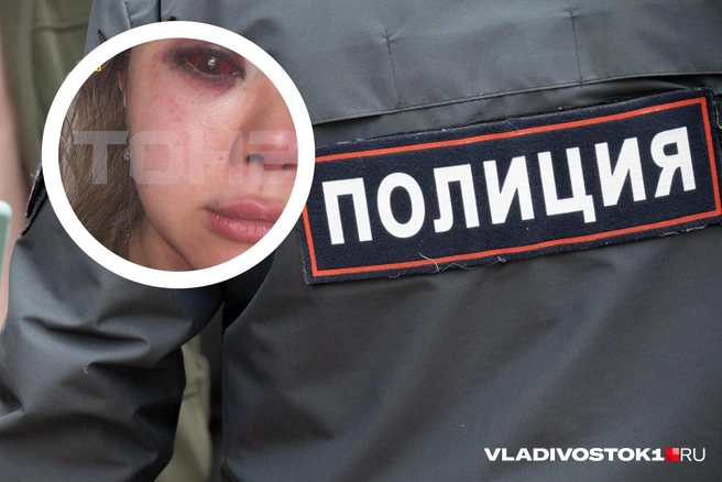 Девушка получила серьезную травму | Источник: «SHOT» / t.me, Елена Буйвол / VLADIVOSTOK1.RU