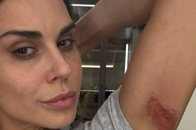 Match TV Host Olga Petrikova Injures Knee on 'Titans' Show