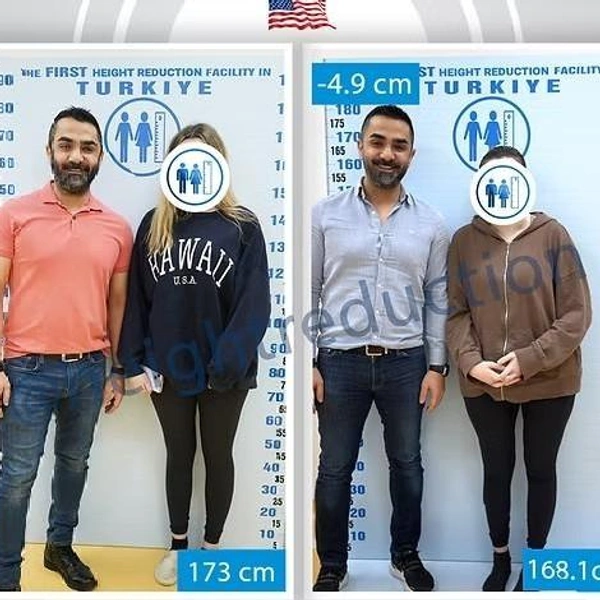 Источник: heightreduction.com