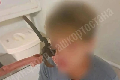 Подросток в Башкирии попал в больницу с секатором в челюсти