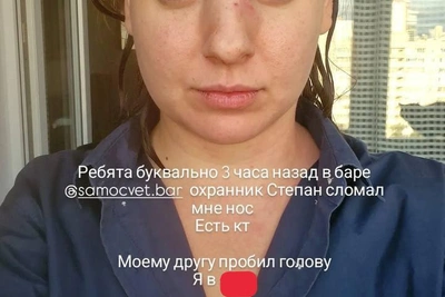 В баре Екатеринбурга девушке сломали нос