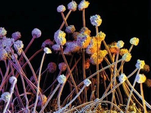 Конидии Aspergillus niger. Этому виду аспергиллов человечество обязано большей частью производимой в мире лимонной кислоты и… «грибными» отитами (отомикозами) — инфекционными воспалениями слухового канала | Источник: SPL / EAST NEWS