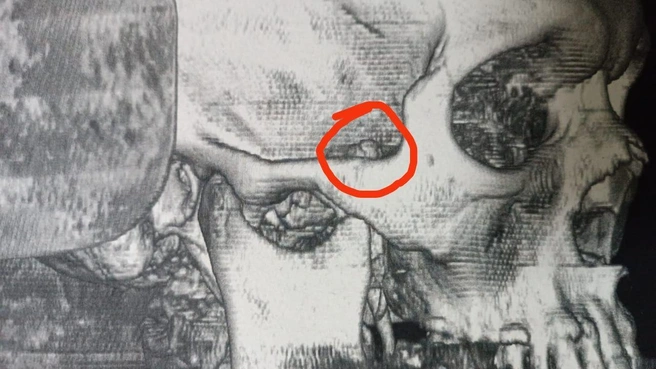 Источник: пресс-служба ГБСМП