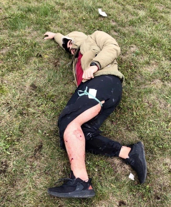 Абдулла получил ранения ног и живота | Источник: очевидец случившегося