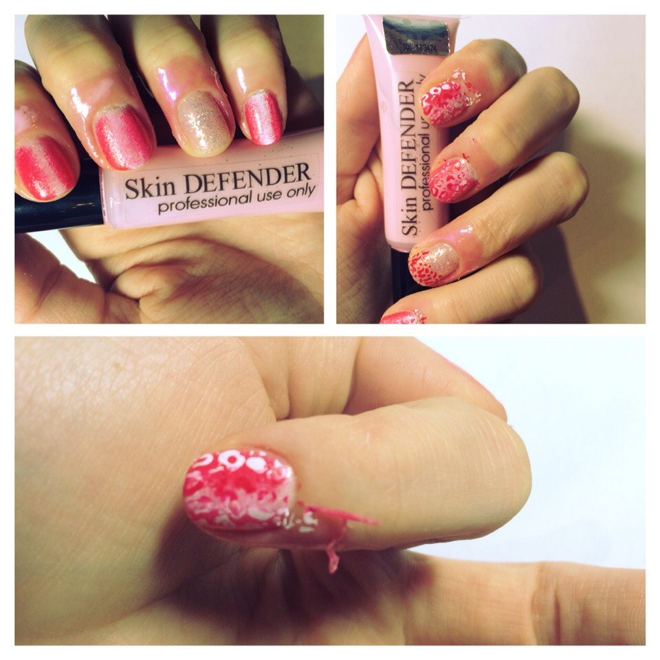 ���� �������. Skin Defender. �������� �������� ��� �������� �� ����� �������� � ���������. ��� ��������