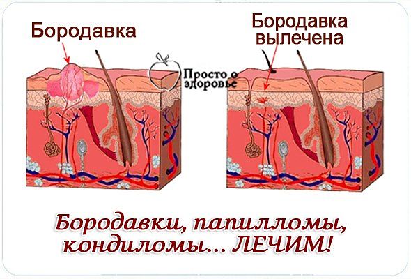 ����� ���������, ���������, ���������