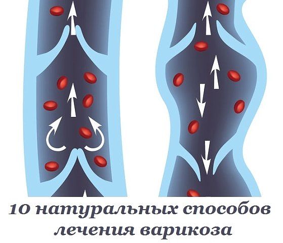 10 ����������� �������� ������� ��������