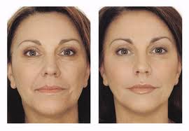 ���� �������. ���������� - �����������. ��������� ������� �� ����� �� �����-9