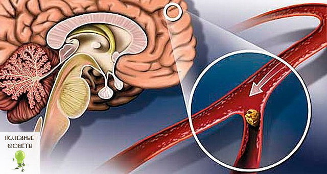 �������� �������� ��� ��������� ��������� ��������������