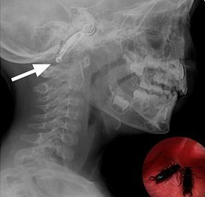 ��������� ��� ������