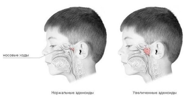 ��� ���������� �� ��������� ��� ��������?