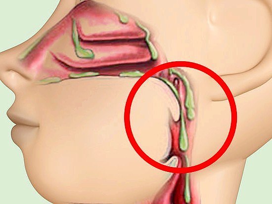 ����� � ���������. ������ ������, ��� ������ � ��� ��������.