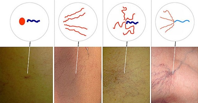 ��� ������ ���������� ��������� �� �����