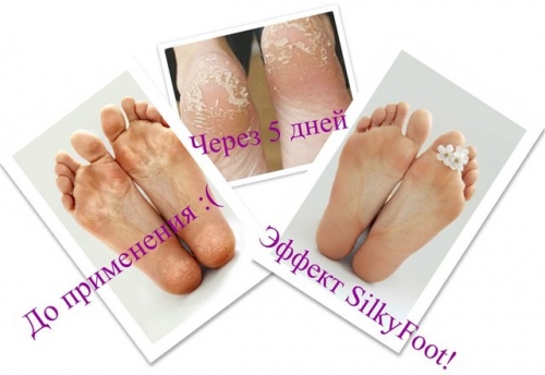 Silky - �������� � ������ �� �������!