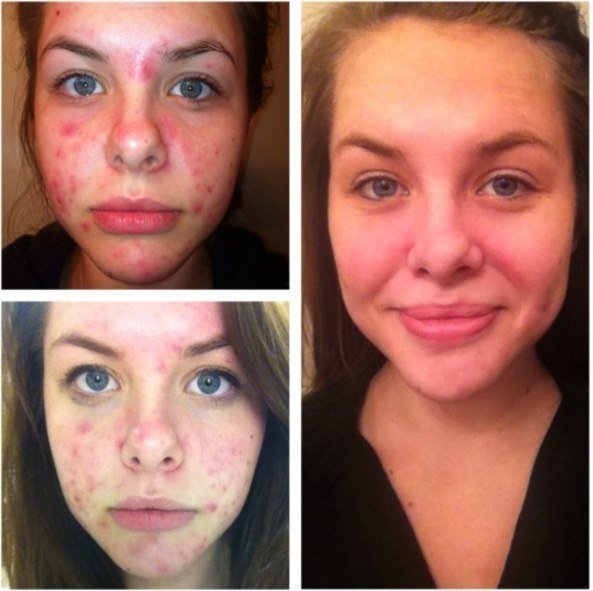 ���� �������. ���������� ������������� ���� �� ������ Volcanic Ash �� ���. ��� �����. ����� 4